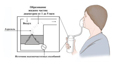 Regler for brug af en inhalator: hvordan det fungerer, og hvorfor?